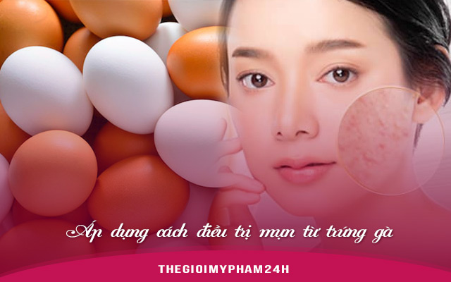 Áp dụng cách điều trị mụn từ trứng gà