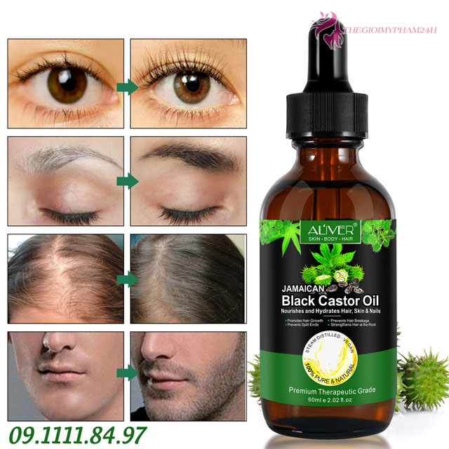 Công dụng của Aliver Jamaican Black Castor Oil 