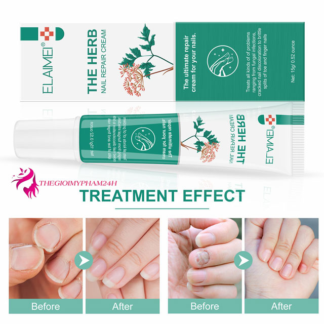 Công dụng Elaimei The Herb Nail Repair Cream