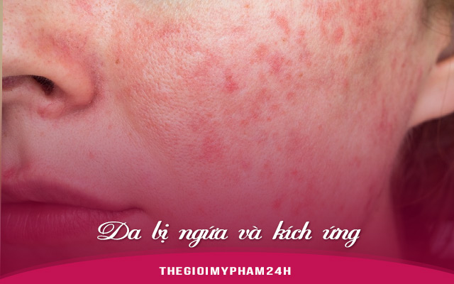 Da bị ngứa và kích ứng