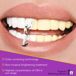 Elaimei V34 Teeth Whitening Mousse 1
