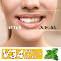 Elaimei V34 Teeth Whitening Mousse 4