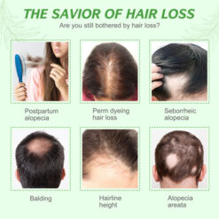 Elbbub Rosemary Essential Oil 3