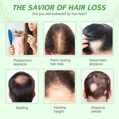 elbbub-rosemary-essential-oil-logo-3 Elbbub Rosemary Essential Oil 3