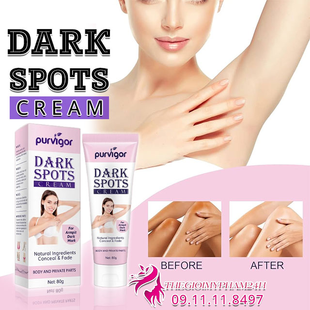 giới thiệu purvigor dark spots cream