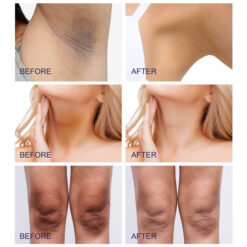 Purvigor Dark Spots Cream 8