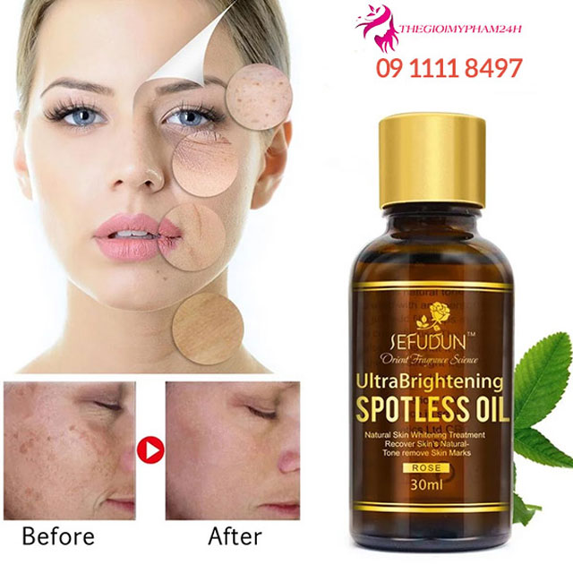 Serum Hoa Hồng Sefudun Ultra Brightening Spotless Oil là gì