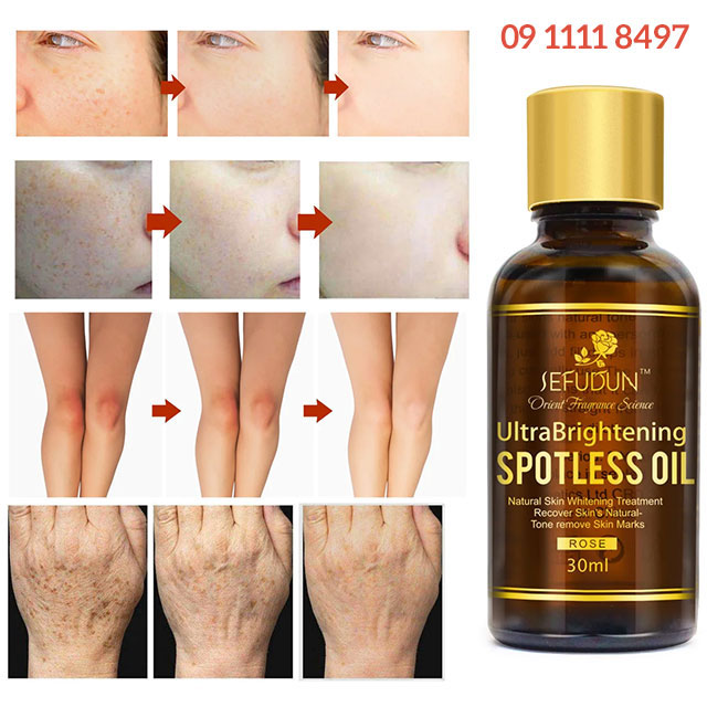 Công dụng của Serum Hoa Hồng Sefudun Ultra Brightening Spotless Oil