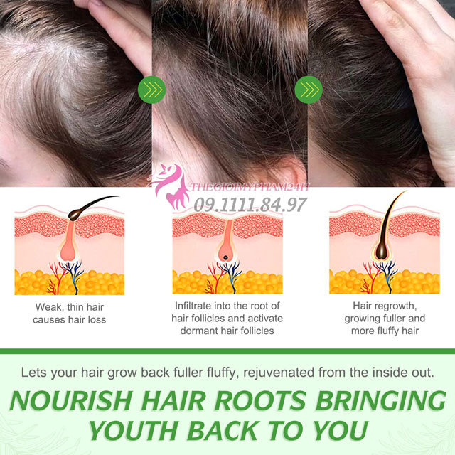 tác dụng của Elbbub Rosemary Essential Oil