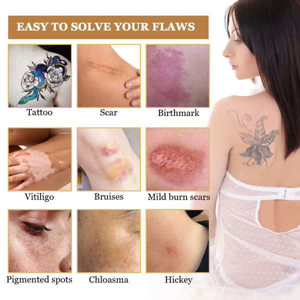 tattoo-concealer-ava-5 Tattoo Concealer 5