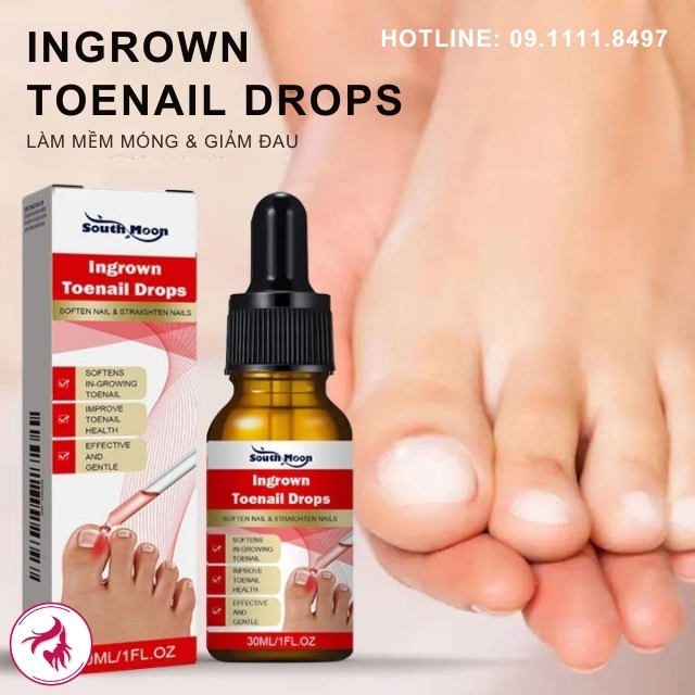 South Moon Drops: Giải pháp đột phá không cần can thiệp dao kéo