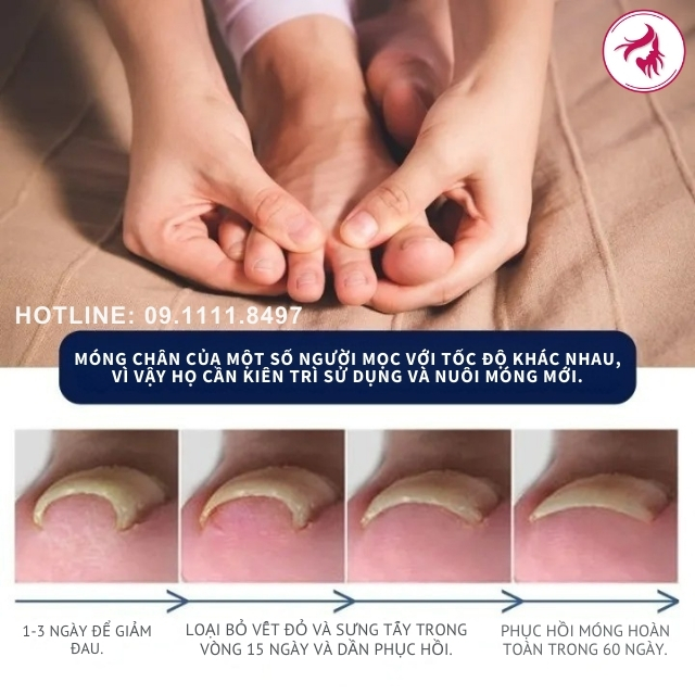 Hướng dẫn sử dụng chi tiết & Cam kết thời gian