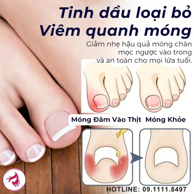 Lộ trình phục hồi cam kết: Từ giảm đau đến móng khỏe mạnh