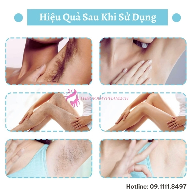 Dịu Nhẹ Tuyệt Đối - Nói Không Với Cảm Giác Đau Rát, Châm Chích